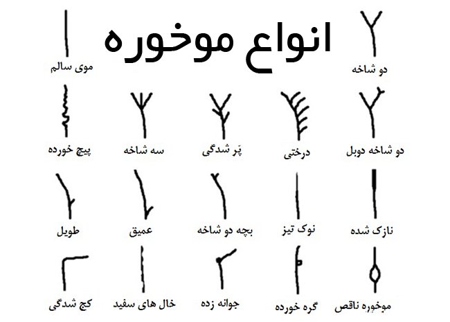 خرید دستگاه موخوره گیر