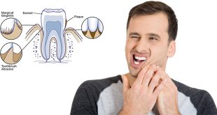 Understanding Teeth Sensitivity