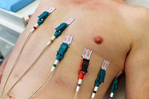 تفاوت بین اکوکاردیوگرام و اکوکاردیوگرافی چیست؟