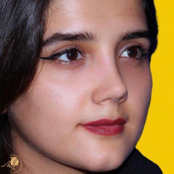 اولین عمل بینی ایران را چه کسی انجام داد؟