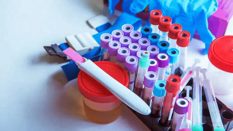 آزمایش ادرار بارداری در منزل