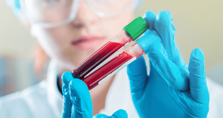 آزمایش چکاپ کامل خون را به متخصصین آنی آزما بسپارید
