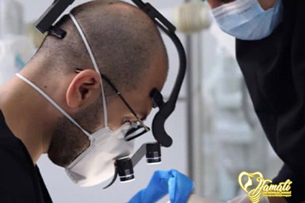 بهترین متخصص ایمپلنت دندان