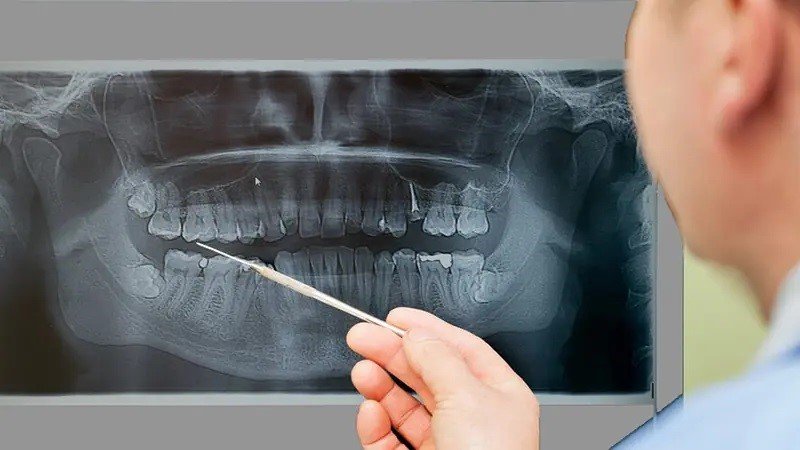 عکس CBCT در رادیولوژی فک و صورت سعادت آباد