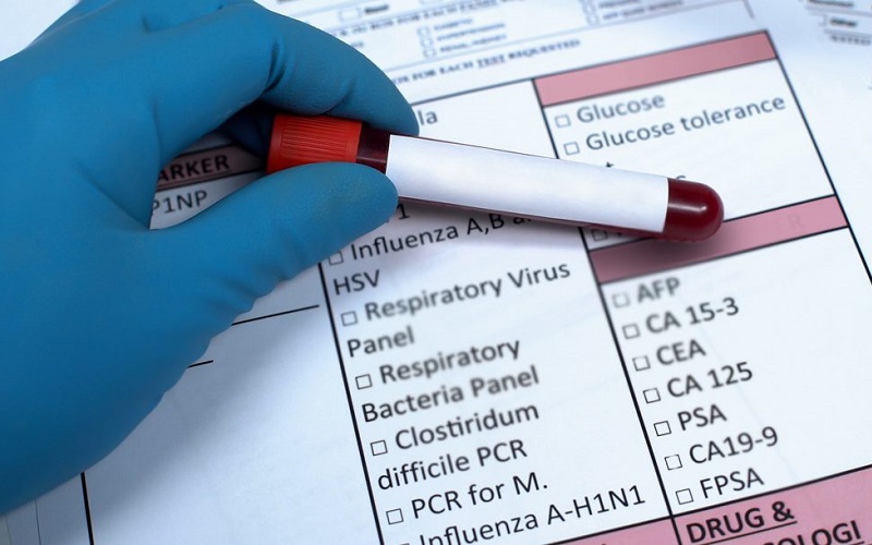 آزمایش چکاپ چیست و هر چند وقت یکبار انجام می شود؟