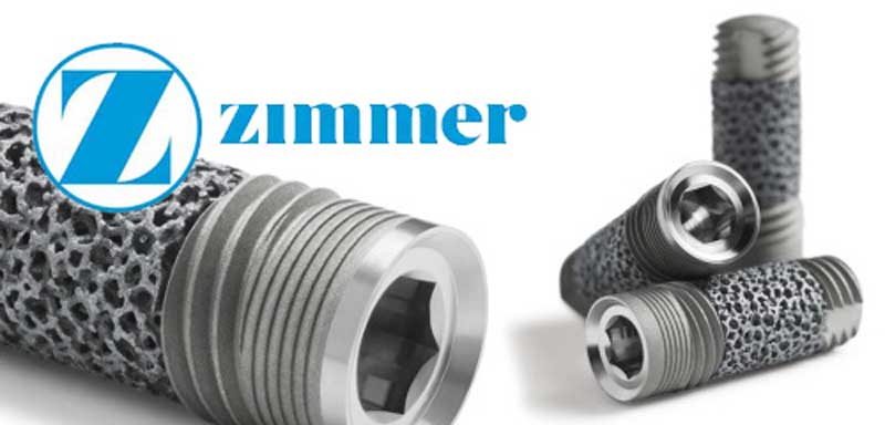 ایمپلنت زیمر آمریکایی