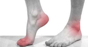 علت درد کف پا + درمان درد کف پا
