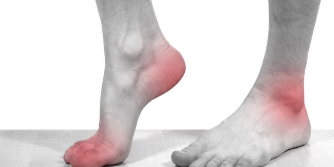 علت درد کف پا + درمان درد کف پا