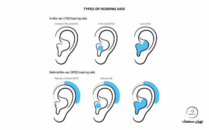 آشنایی با انواع سمعک و کاربردهای آن