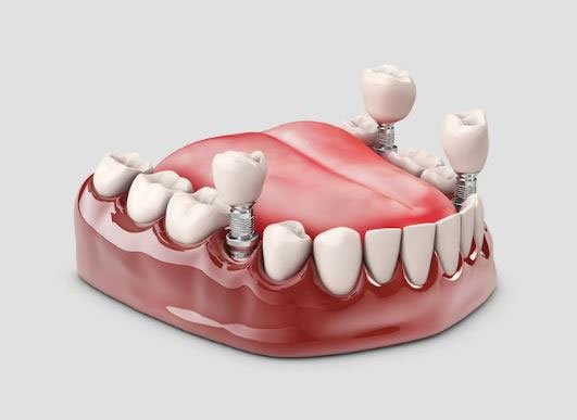 دندانپزشکی با وام قرض الحسنه بانک مهر در اصفهان