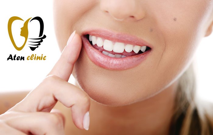 راهنمای جامع دندان مصنوعی و سفید کردن دندان