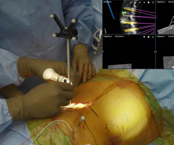 انواع جراحی ستون فقرات چگونه است ؟