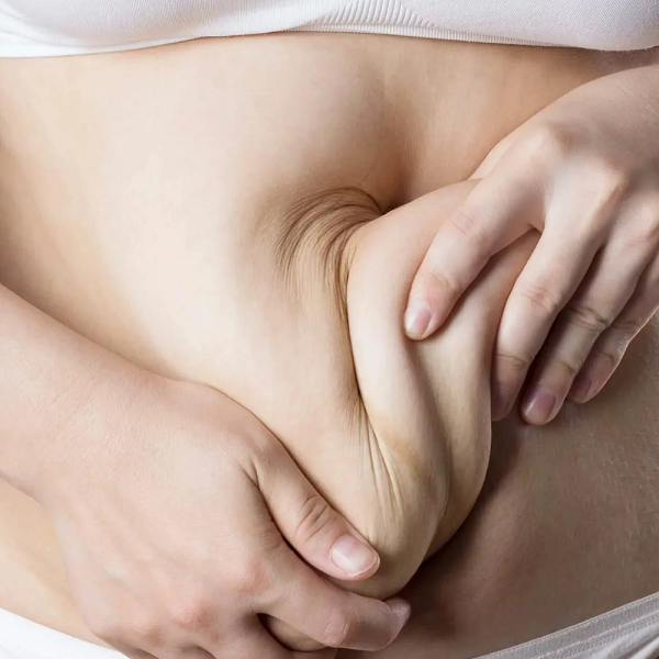 همه چیز در مورد عمل ابدومینوپلاستی و مینی ابدو : روش انجام ، مزایا و نکات مهم پیش و پس از عمل جراحی