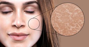 کرم مرطوب‌کننده خیلی خوب برای پوست‌های خشک