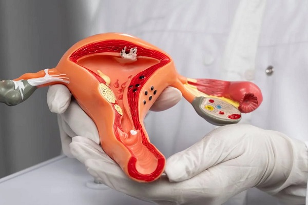 راهنمای جامع وایتنینگ واژینال