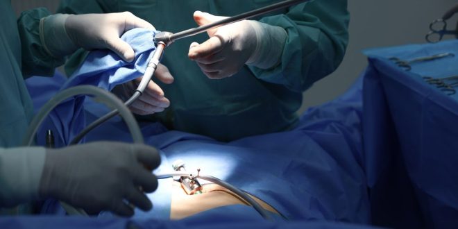 سریعترین روش لاغری شکم و پهلو به کمک اسلیو معده