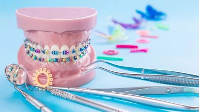 مهم ترین ابزار مورد نیاز ارتودنسی